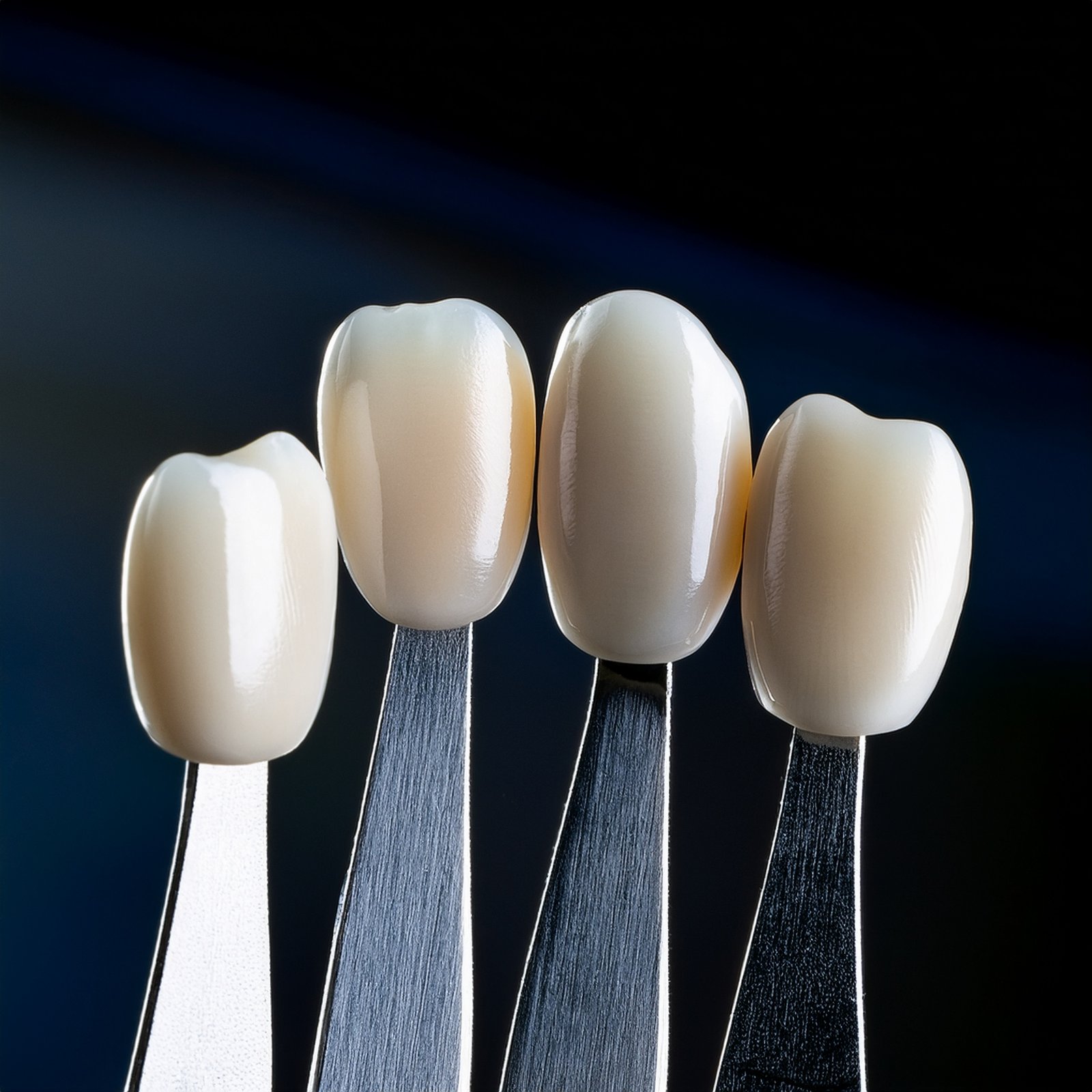 Dental Veneers and Smile Designing